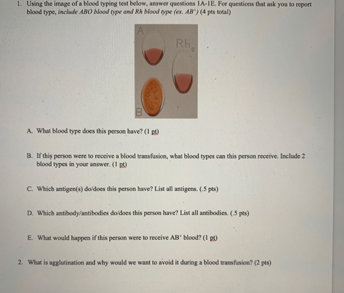 Blood typing game answer key